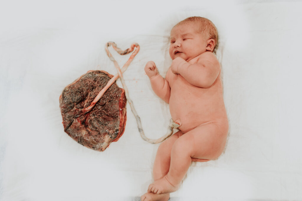 Amor en cada detalle: el cordón ᴜmbilical de un recién nacido forma la palabra ‘LOVE’ en una foto, una sorpresa que calienta corazones